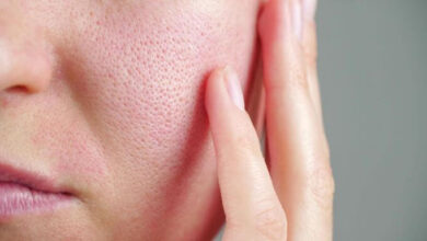 shrink-pores